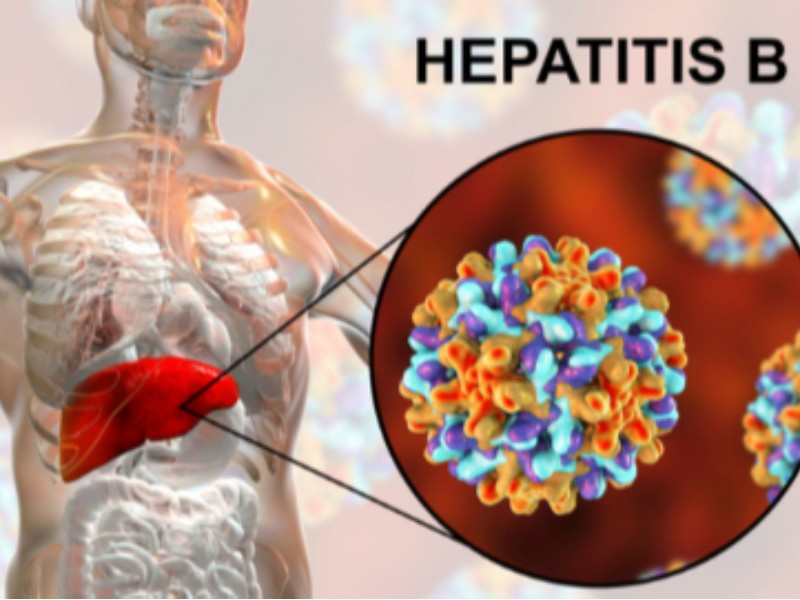  پیشگیری از هپاتیت B با رعایت نکات ساده
