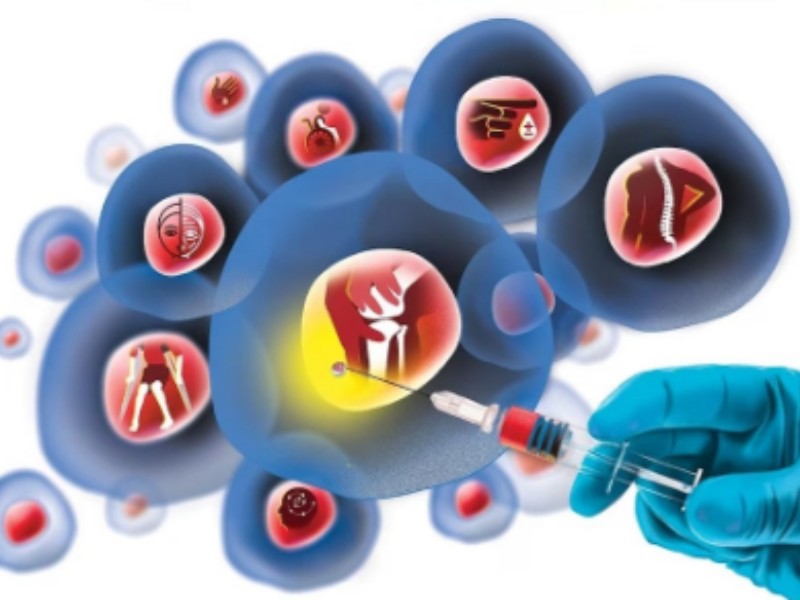 درمان با سلول‌های بنیادی چگونه کار می‌کند
